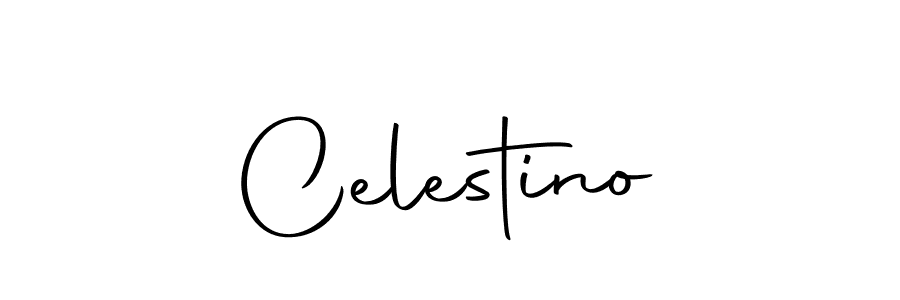 Also we have Celestino name is the best signature style. Create professional handwritten signature collection using Autography-DOLnW autograph style. Celestino signature style 10 images and pictures png