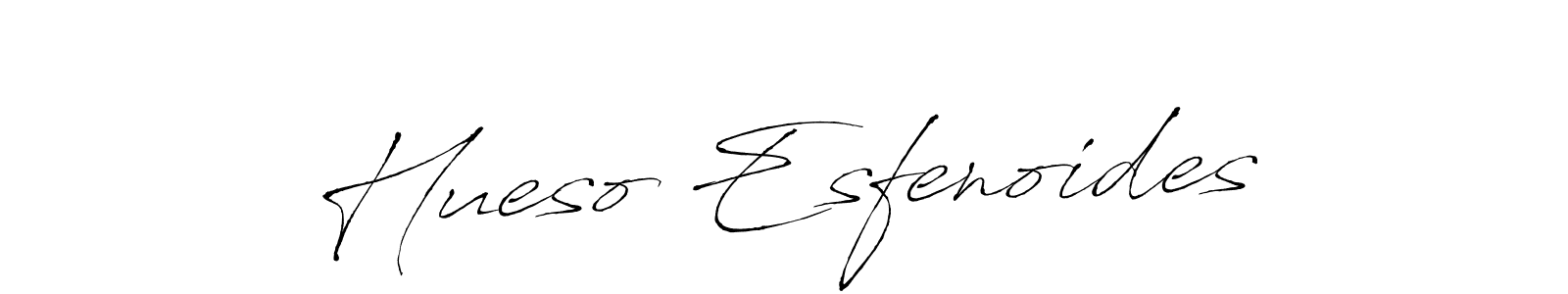 It looks lik you need a new signature style for name Hueso Esfenoides. Design unique handwritten (Antro_Vectra) signature with our free signature maker in just a few clicks. Hueso Esfenoides signature style 6 images and pictures png