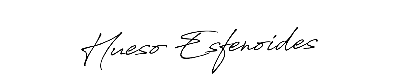 How to Draw Hueso Esfenoides signature style? Antro_Vectra_Bolder is a latest design signature styles for name Hueso Esfenoides. Hueso Esfenoides signature style 7 images and pictures png