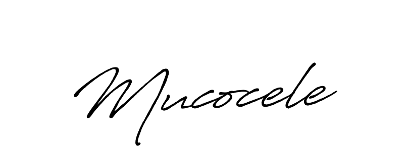 Check out images of Autograph of Mucocele name. Actor Mucocele Signature Style. Antro_Vectra_Bolder is a professional sign style online. Mucocele signature style 7 images and pictures png